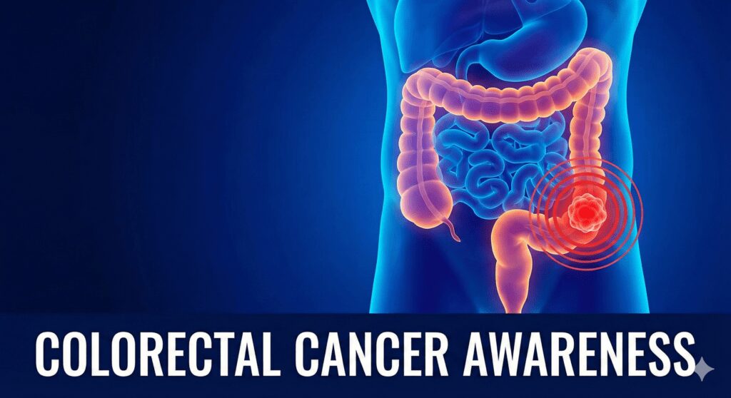 Colorectal cancer
