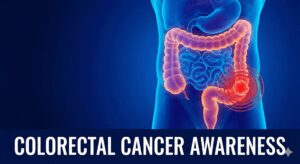 Colorectal cancer