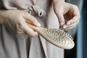 what lack of vitamins causes hair loss