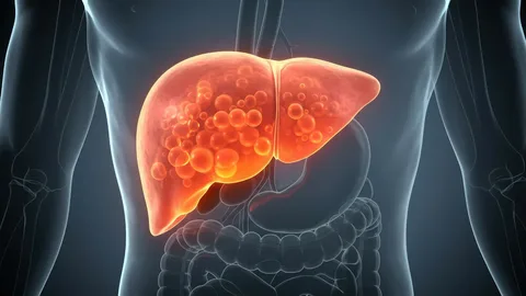 symptoms of fatty liver