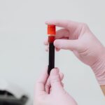 iron deficiency without anemia