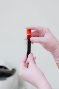 iron deficiency without anemia