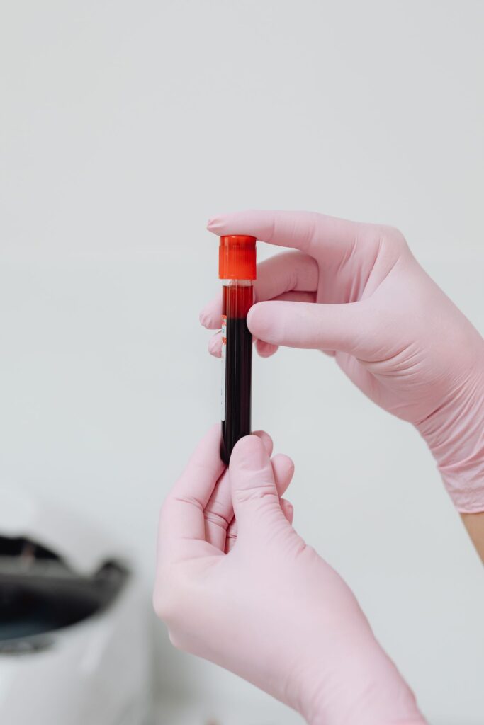 iron deficiency without anemia