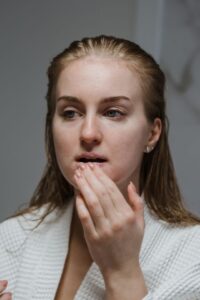 Peeling lips