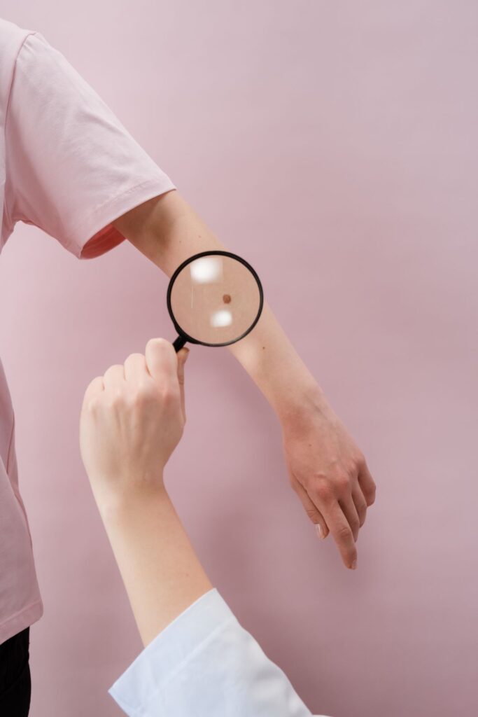 what is petechiae