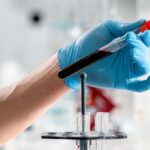 what does high mcv mean in a blood test