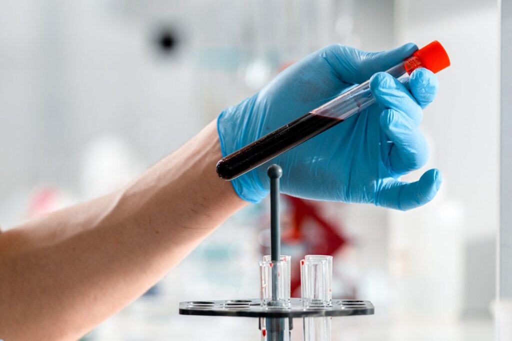 what does high mcv mean in a blood test