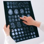 vagus nerve dysfunction symptoms