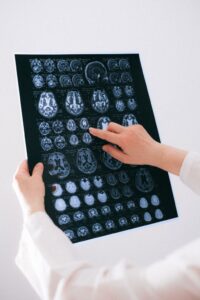 vagus nerve dysfunction symptoms