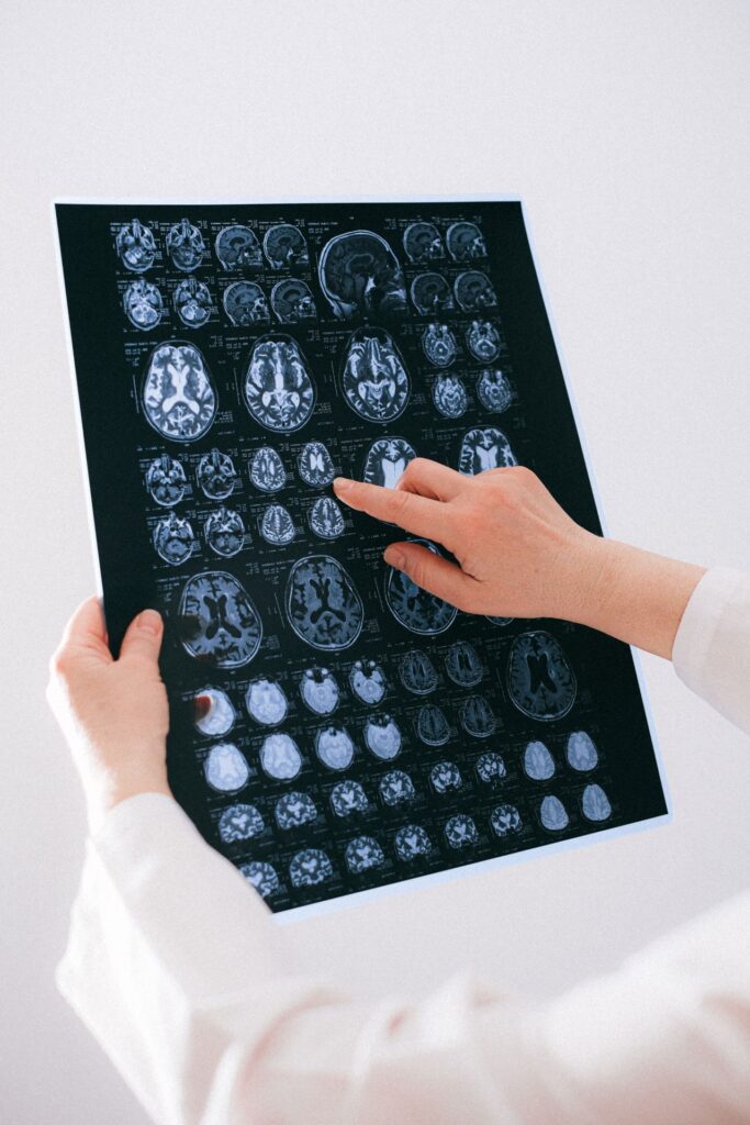 vagus nerve dysfunction symptoms