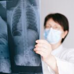 Pneumonia causes