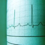 how to improve heart rate variability