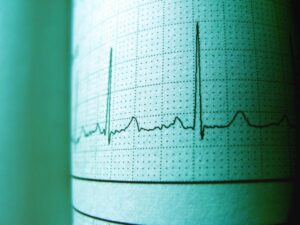 how to improve heart rate variability