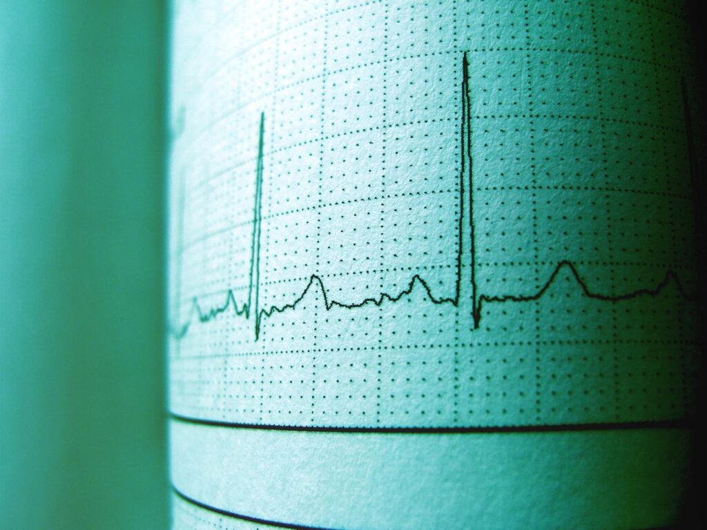 how to improve heart rate variability