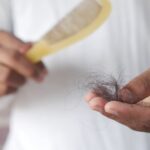 Could your diet choic be causing hair loss?