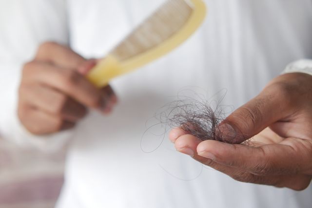 Could your diet choic be causing hair loss?