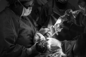 Cesarean section