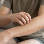 itchy skin without a rash causes